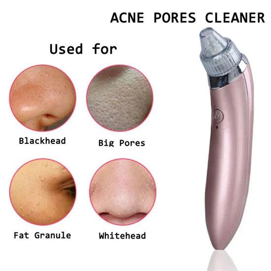 Blackhead Remover Facial Cleaner Anglic
