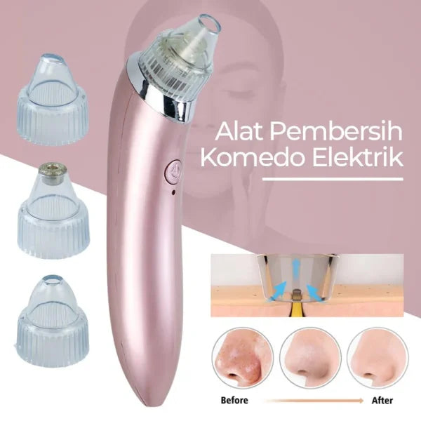 Blackhead Remover Facial Cleaner Anglic