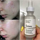 The Ordinary Niacinamide 10% + Zinc 1% – 30ml Anglic